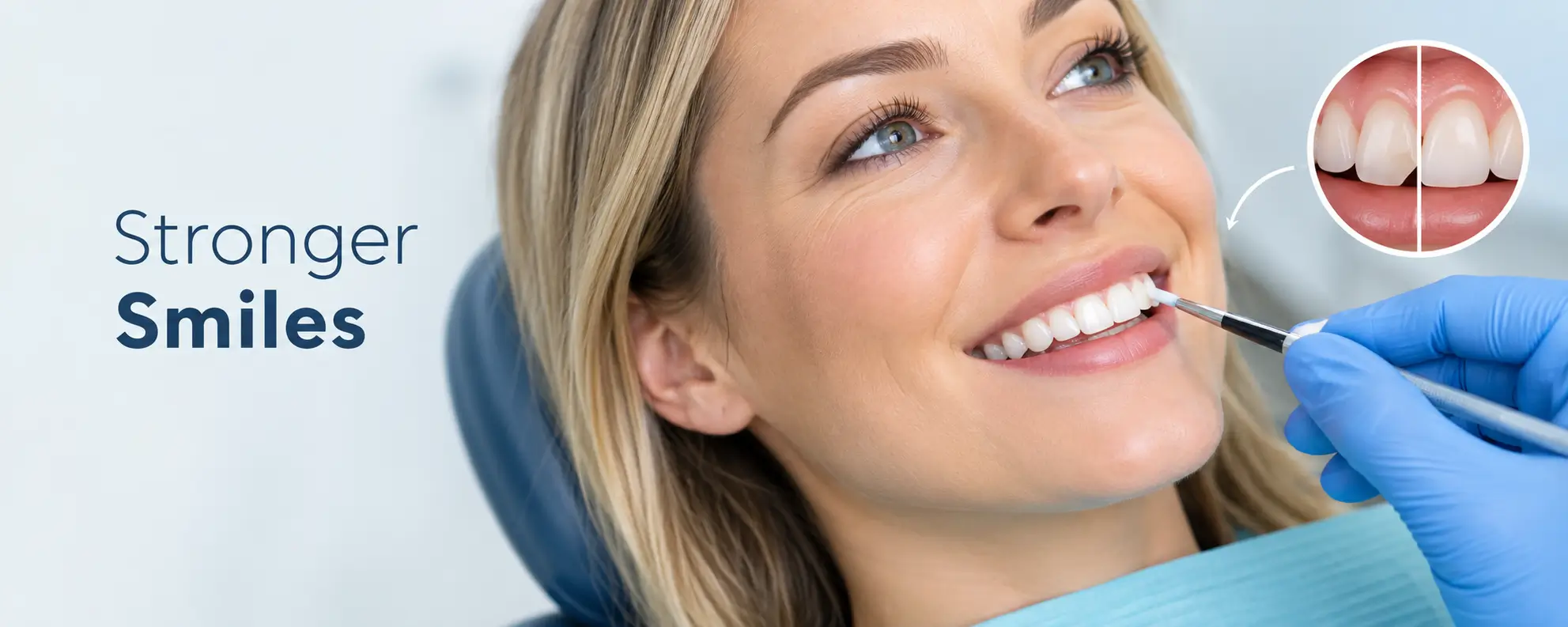 composite teeth bonding in surrey